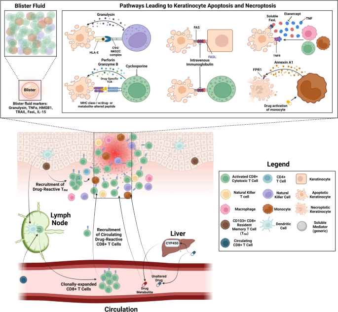 glutathione steven johnson syndrome Update on Stevens–Johnson Syndrome and Toxic Epidermal Necrolysis:  Diagnosis and Management | American Journal of Clinical Dermatology