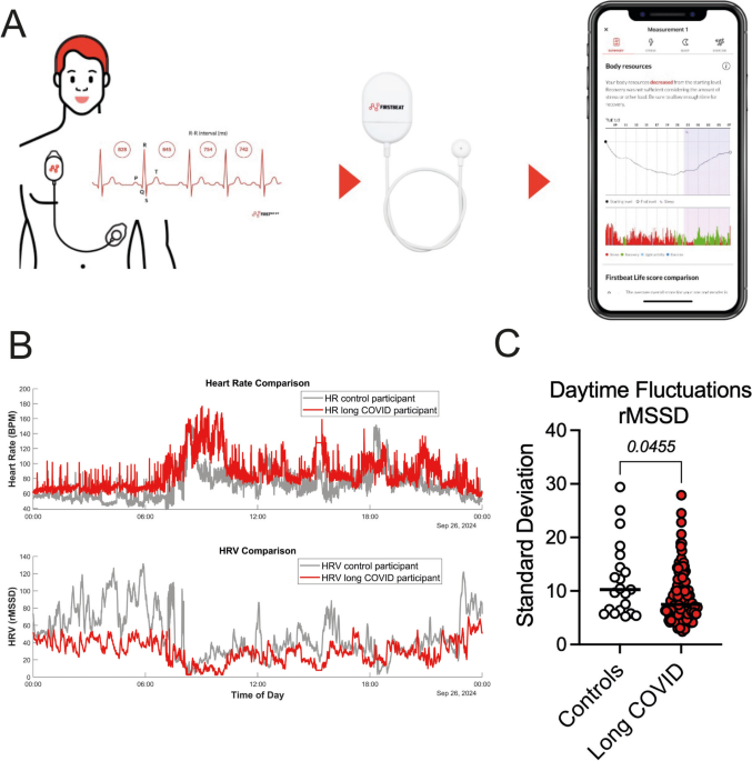 Wearable Heart Rate Variability Monitoring, Autonomic Dysfunction and Post-exertional Malaise in Long COVID: An Observational Study - Sports Medicine