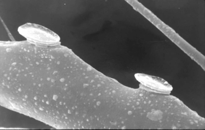 16+ Dust Mite Dander Or Plants