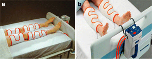 Mechanical Prophylaxis for Post-Traumatic VTE: Stockings and Pumps |  Current Trauma Reports