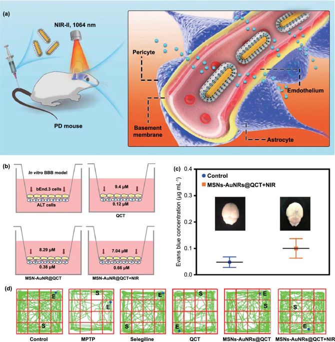 Bioinspired Theranostic Coordination Polymer Nanoparticles for Intranasal  Dopamine Replacement in Parkinson's Disease