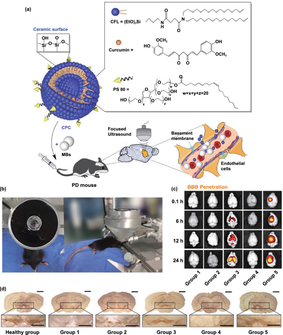 Bioinspired Theranostic Coordination Polymer Nanoparticles for Intranasal  Dopamine Replacement in Parkinson's Disease