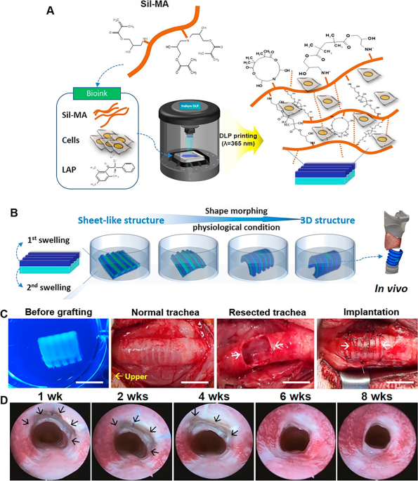 Photocrosslinkable Silk-Based Biomaterials for Regenerative Medicine and  Healthcare Applications