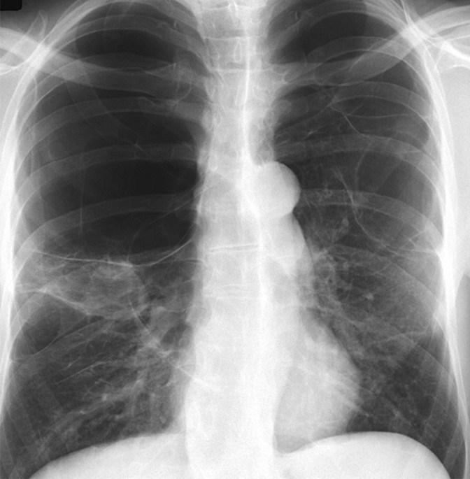 Cannabis and Lung Health: Does the Bad Outweigh the Good? | Pulmonary  Therapy