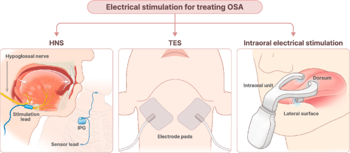 telehealth services compounded tirzepatide injections Tirzepatide Injection HomeKit