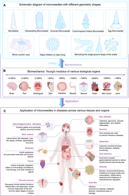 Advancing microneedle technology for multiple distinct target organs drug delivery through 3D printing: a comprehensive review | Advanced Composites and Hybrid Materials
