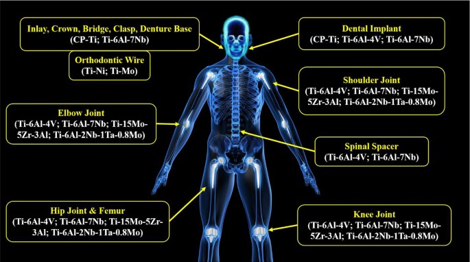 A state-of-the-art review of the fabrication and characteristics of titanium  and its alloys for biomedical applications | Bio-Design and Manufacturing