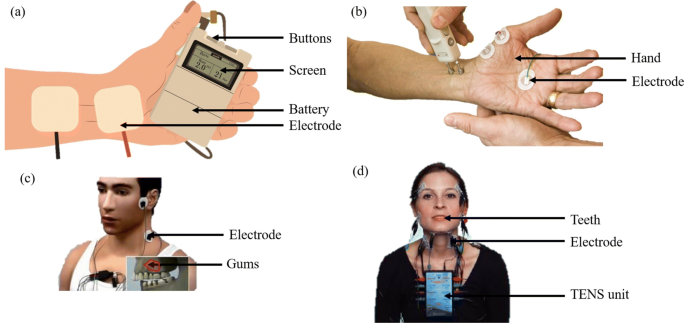 Transcutaneous Electric Nerve Stimulation (TENS) for Arthritis Pain