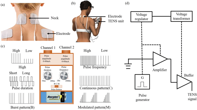 A Review on Transcutaneous Electrical Nerve Stimulation and its  Applications | SN Comprehensive Clinical Medicine