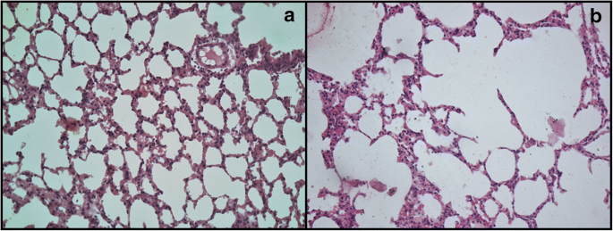 Pulmonary Emphysema Impairs Male Reproductive Physiology Due To  Testosterone and Oxidative Stress Imbalance in Mesocricetus auratus |  Reproductive Sciences