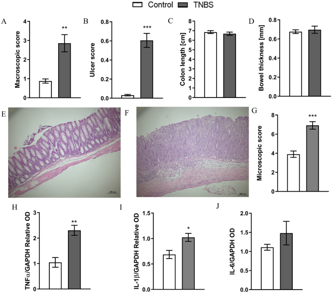 ulcerative colitis glp-1 Colonic inflammation induces changes in glucose levels through modulation  of incretin system | Pharmacological Reports
