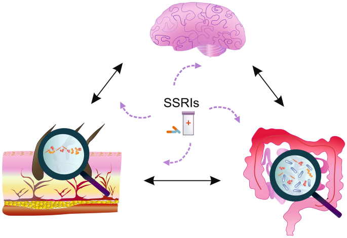 bpc 157 and ssri The potential action of SSRIs in the treatment of skin diseases including  atopic dermatitis and slow-healing wounds | Pharmacological Reports
