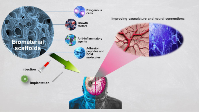 Emerging scaffold- and cellular-based strategies for brain tissue  regeneration and imaging