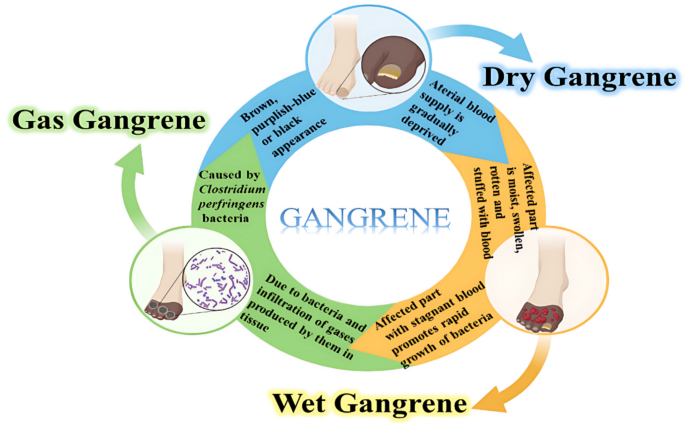 glutathione foul smelling gas 9 Health Benefits of Potential mechanisms of H2S-induced cytotoxicity.