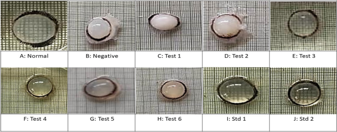 The anti-cataract properties of humic acid on glucose-induced cataracts in goat eye lenses | Discover Medicine | Springer Nature Link The anti-cataract properties of humic acid on glucose-induced cataracts in goat eye lenses | Discover Medicine | Springer Nature Link