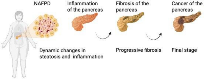 glp-1 pancreatitis law office in kentucky Current Status of Glucagon-like Peptide-1 Receptor Agonists in Metabolic Dysfunction-associated Steatotic Liver Disease: A Clinical Perspective glp-1 pancreatitis law office in kentucky Current Status of Glucagon-like Peptide-1 Receptor Agonists in Metabolic Dysfunction-associated Steatotic Liver Disease: A Clinical Perspective