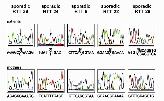 Rett syndrome is caused by mutations in x-linked mecp2, encoding methyl-cpg-binding protein 2