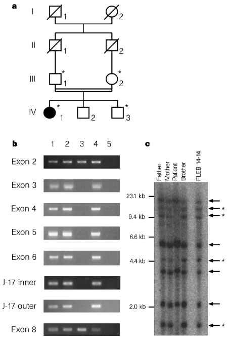Mutations In The Parkin Gene Cause Autosomal Recessive Juvenile A Filled Circle Represents The Affected Woman Iv 1 Open Circles Women And Squares Men Represent Normal Individuals Asterisks Indicate Family