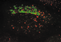 Stressing endocytosis | Nature Cell Biology