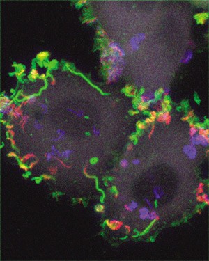 Vaccinia virus on the move | Nature Reviews Molecular Cell Biology