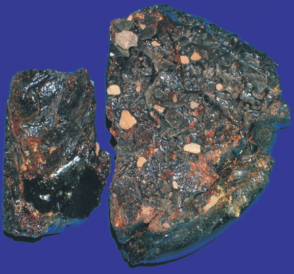 Analysis of a pharaonic embalming tar