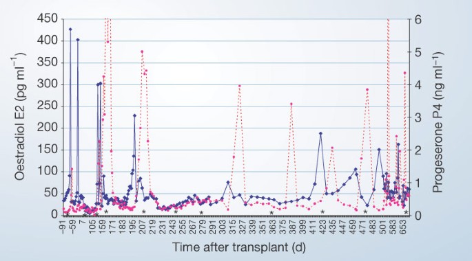 Live birth after ovarian tissue transplant