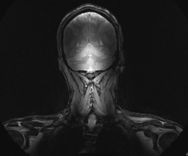 MRI rides the wave | Nature
