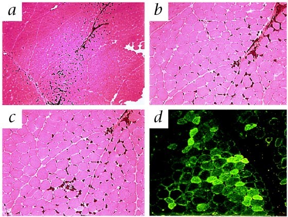 Long-term correction of canine hemophilia b by gene transfer of blood coagulation factor ix mediated by adeno-associated viral vector