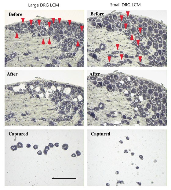 Gene expression profiles of laser-captured adjacent neuronal subtypes