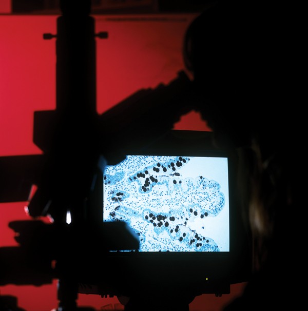 feature-image