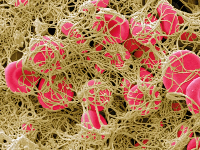 Thrombosis: Balancing act | Nature