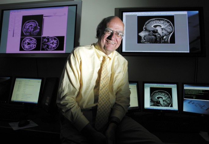 Neuroscience: Halving it all | Nature