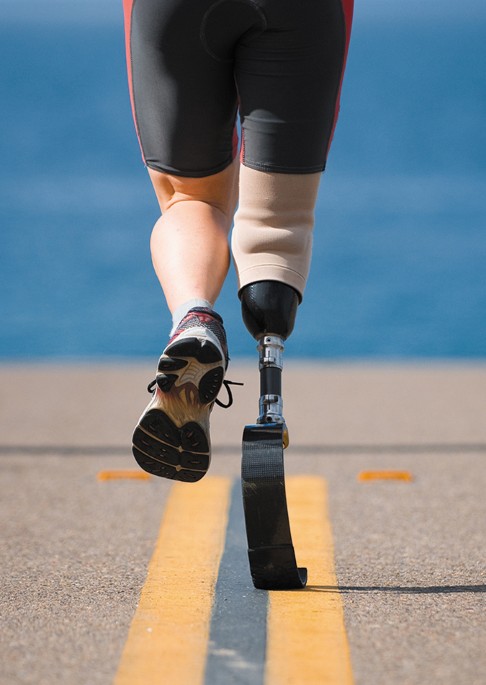 Right prosthetic legs have the edge | Nature