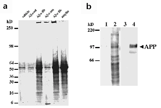 Amyloid β interacts with the amyloid precursor protein: a potential toxic mechanism in Alzheimer's disease