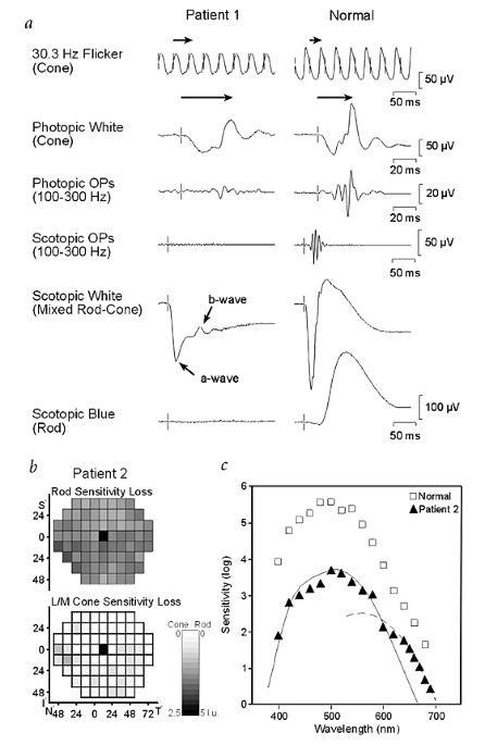 Mutations in NYX, encoding the leucine-rich proteoglycan nyctalopin, cause X-linked complete congenital stationary night blindness