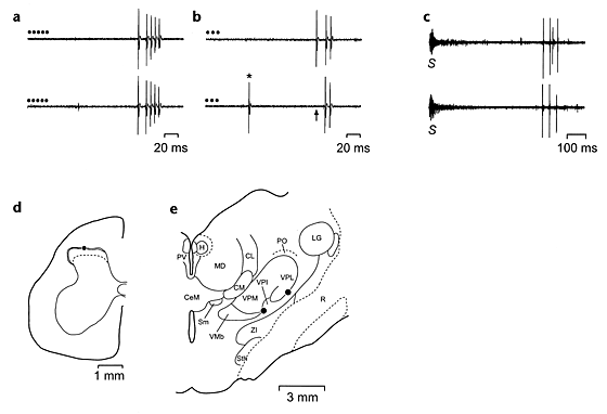 Spinothalamic lamina i neurons selectively sensitive to histamine: a central neural pathway for itch