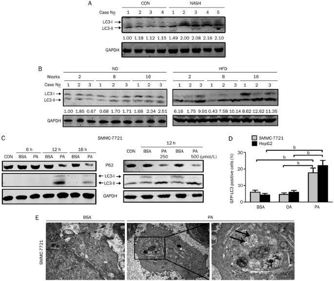 Palmitic acid induces autophagy in hepatocytes via jnk2 activation