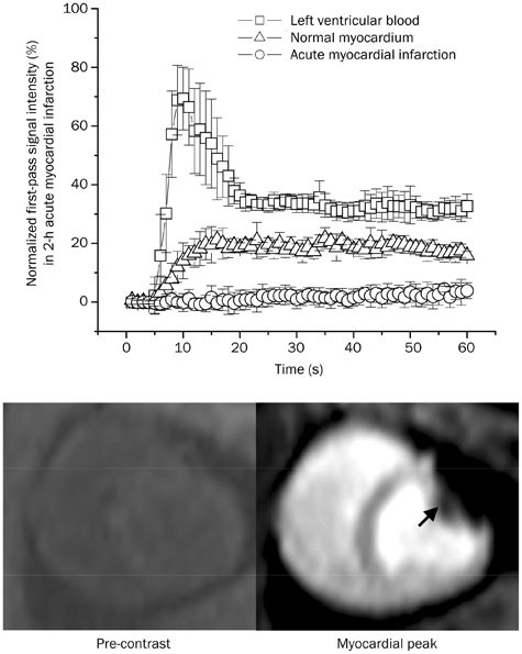 Collateral circulation formation determines the characteristic profiles of contrast-enhanced MRI in the infarcted myocardium of pigs