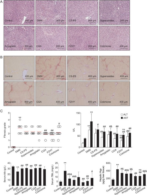 Chinese Medicine Cga Formula Ameliorates Dmn Induced Liver Fibrosis In Rats Via Inhibiting Mmp2 9 Timp1 2 And The Tgf B Smad Signaling Pathways Acta Pharmacologica Sinica