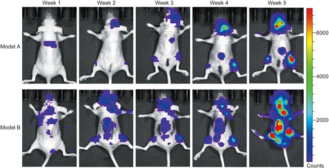 Wenshen zhuanggu formula effectively suppresses breast cancer bone metastases in a mouse xenograft model