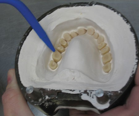Bonding Resin Teeth