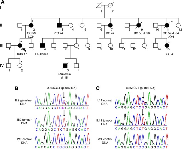 Mutation Analysis Of Rad51d In Non Brca1 2 Ovarian And Breast Cancer Families British Journal Of Cancer