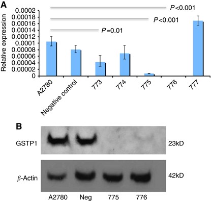 Glutathione s-transferase p1 (gstp1) directly influences platinum drug chemosensitivity in ovarian tumour cell lines