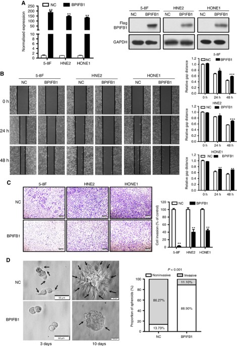 Bpifb1 Lplunc1 Inhibits Migration And Invasion Of - 