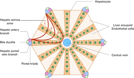 Sinusoidal obstruction syndrome/veno-occlusive disease: current situation  and perspectives—a position statement from the European Society for Blood  and Marrow Transplantation (EBMT) | Bone Marrow Transplantation