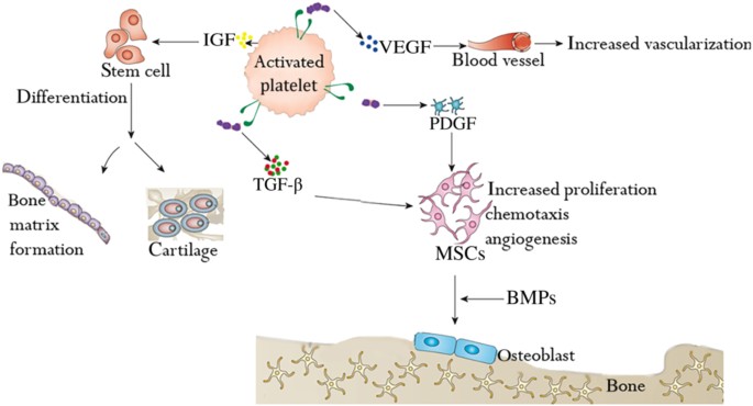 Application Of Platelet Rich Plasma With Stem Cells In Bone - 