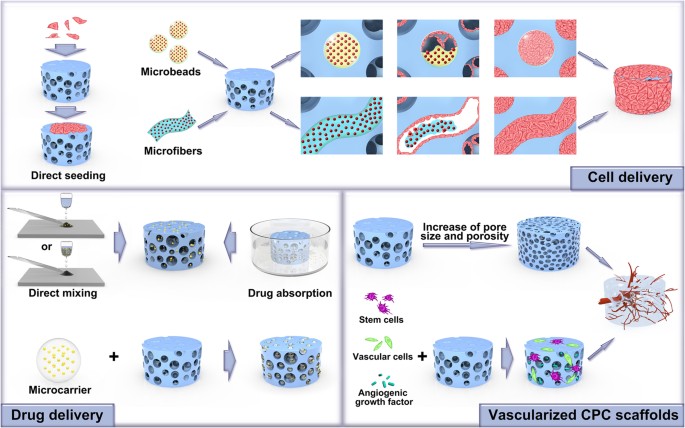 The use of bone substitutes in spine surgery a state of the art review