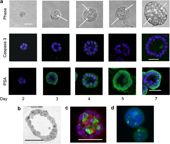 Polarized fluid movement and not cell death, creates luminal spaces in adult prostate epithelium
