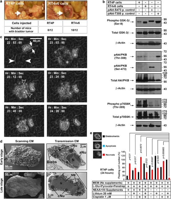 Blebbishields The Emergency Program For Cancer Stem Cells