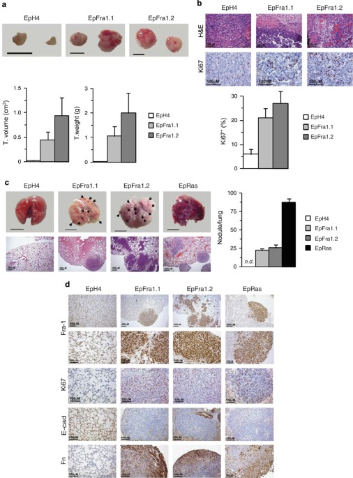 Fra-1/AP-1 induces EMT in mammary epithelial cells by modulating Zeb1/2 and  TGFβ expression